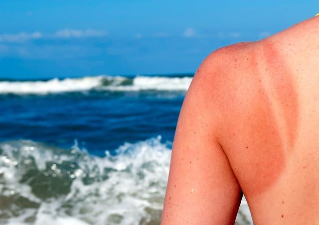 12 popular myths about suntan