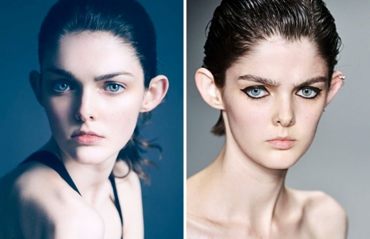 12 models that turned the defects of their appearance into highlights