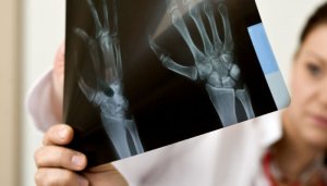 5 Ways Rheumatoid Arthritis is Different