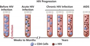 STAGES OF HIV INFECTION : Term Life | Med Log