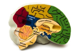 5 things to know about brain aneurysms:Term Life
