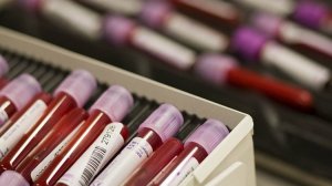 Blood test to detect Parkinson’s disease could lead to earlier treatment