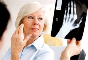 Rheumatoid Arthritis Treatment Adherence Improved with Positive Expectations, Information:Term life