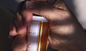 Brain aneurysm Treatments and drugs
